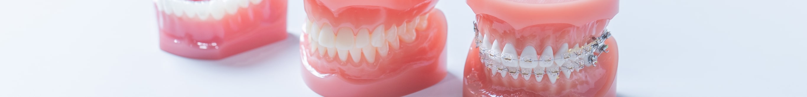 ブラケットを用いた矯正治療 Bracket orthodontics